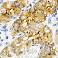 Anti-Ghrelin Antibody