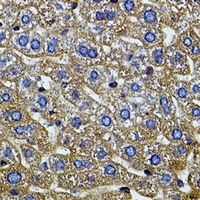 Anti-CETP Antibody
