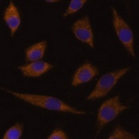UGT1A1 antibody