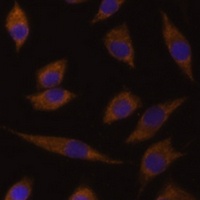 Anti-UGT1A1 Antibody