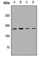 MLL Rabbit Polyclonal Antibody