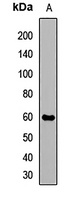 CB1 Rabbit Polyclonal Antibody