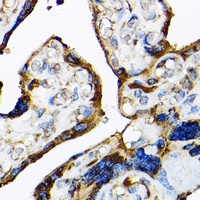 TLR3 antibody