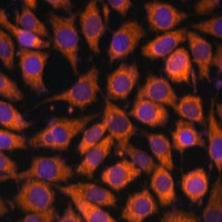 TLR3 antibody