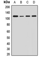 Ah Receptor Antibody
