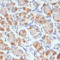 Ah Receptor Antibody