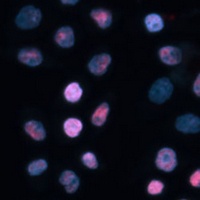 Anti-TET1 Antibody