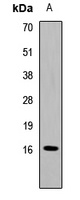 Survivin Antibody
