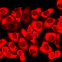 Anti-CHRM2 Antibody