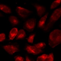 Anti-CD46 Antibody