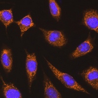 KNG1 antibody