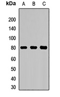 OCTN2 Rabbit Polyclonal Antibody