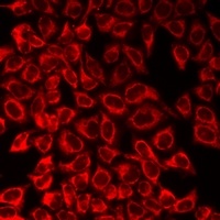 Anti-OCTN2 Antibody