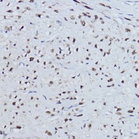 Anti-ERR alpha Antibody