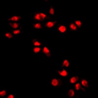 Anti-ERR alpha Antibody