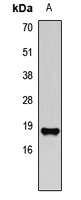 ACP1 Rabbit Polyclonal Antibody