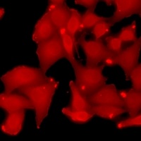 Anti-Rbx1 Antibody