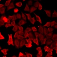 Anti-Surfactant Protein C Antibody