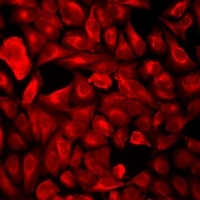 Anti-POLR2J Antibody