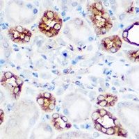Calpain 2 Rabbit Polyclonal Antibody