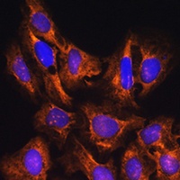 Anti-GNB1 Antibody