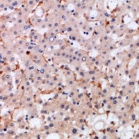 Anti-CCL21 Antibody