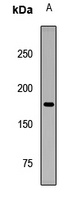 DLC1 Rabbit Polyclonal Antibody