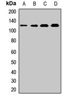 BUB1 Rabbit Polyclonal Antibody