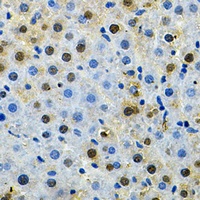 Anti-BUB1 Antibody