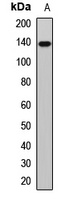 PLC beta 1 Rabbit Polyclonal Antibody