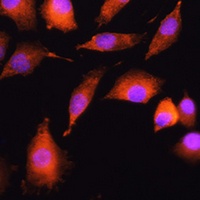 Anti-EXT2 Antibody