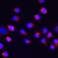 Anti-ACVR2A Antibody
