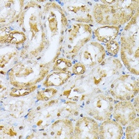 Anti-RPS27A Antibody