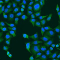 Anti-RPS27A Antibody