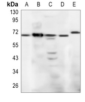 CD94 Rabbit Polyclonal Antibody