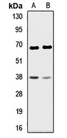 CD150 Rabbit Polyclonal Antibody