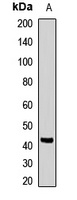 LHX8 Rabbit Polyclonal Antibody
