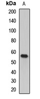 c-FGR Rabbit Polyclonal Antibody