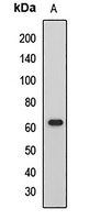 HCK Rabbit Polyclonal Antibody