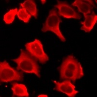 HCK Rabbit Polyclonal Antibody