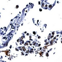 Anti-IL-13 Antibody