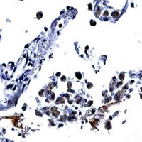 IL13 antibody