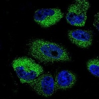 Anti-IL-13 Antibody