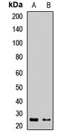 NGAL Rabbit Polyclonal Antibody