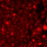 Anti-NGAL Antibody