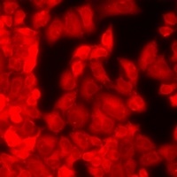 Anti-REG3 alpha Antibody