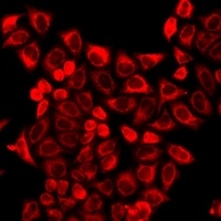 Anti-REG3 gamma Antibody