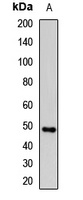 uPA Rabbit Polyclonal Antibody