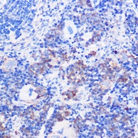 Anti-CD24 Antibody