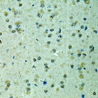 Anti-TIF1 beta Antibody
